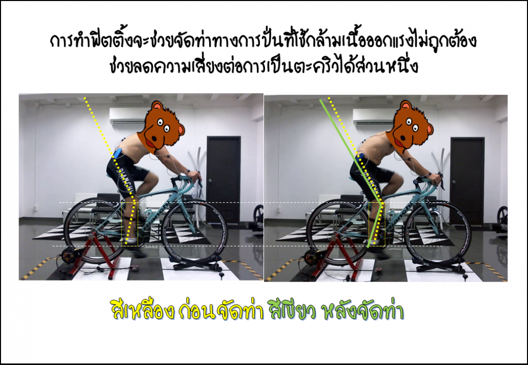 ตัวอย่างการจัดท่าทางการปั่นหลังฟิตติ้ง ซึ่งช่วยลดอาการตะคริวที่น่องได้ภายหลังปรับความสูงอานและตำแหน่งคลีทรองเท้าให้เหมาะสมแล้ว ขอบคุณรูปภาพประกอบการศึกษาจากร้านฟิตติ้งไซคลิ่งโปรเจค